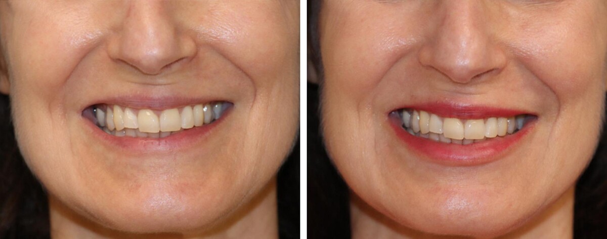 Images Eugenie Brunner, MD, FACS