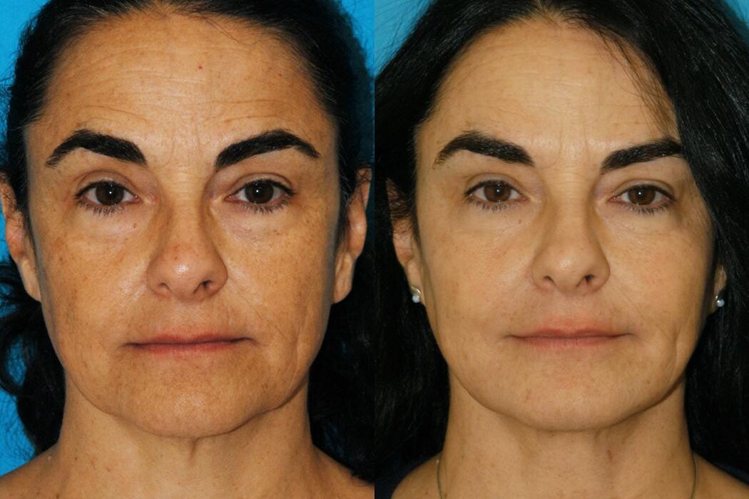 Images Eugenie Brunner, MD, FACS