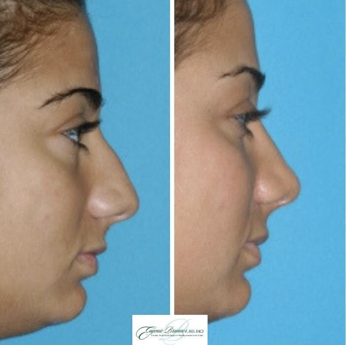 Images Eugenie Brunner, MD, FACS