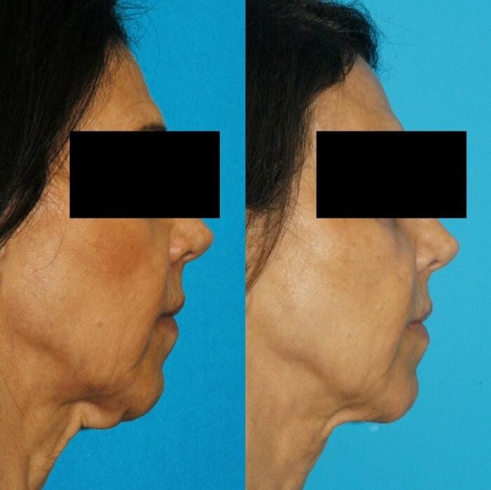 Images Eugenie Brunner, MD, FACS