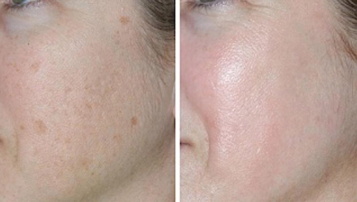 Images Eugenie Brunner, MD, FACS