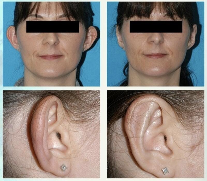 Images Eugenie Brunner, MD, FACS