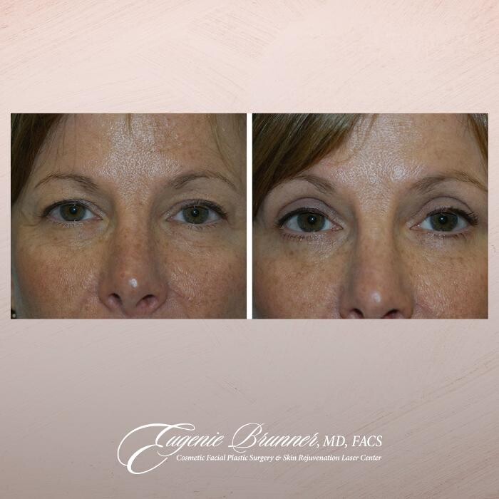 Images Eugenie Brunner, MD, FACS