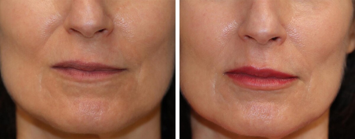 Images Eugenie Brunner, MD, FACS