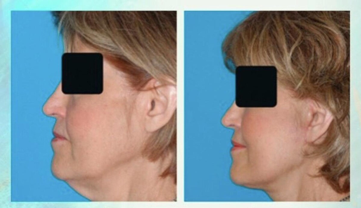 Images Eugenie Brunner, MD, FACS