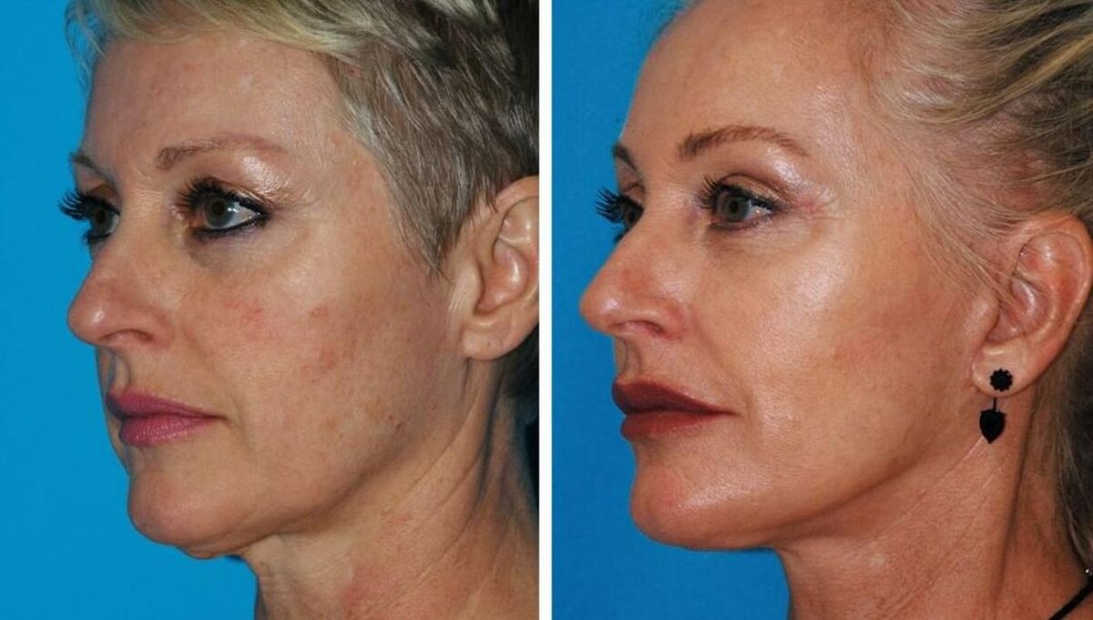 Images Eugenie Brunner, MD, FACS