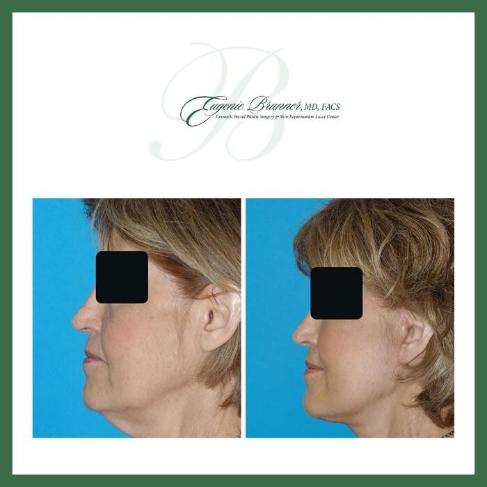 Images Eugenie Brunner, MD, FACS