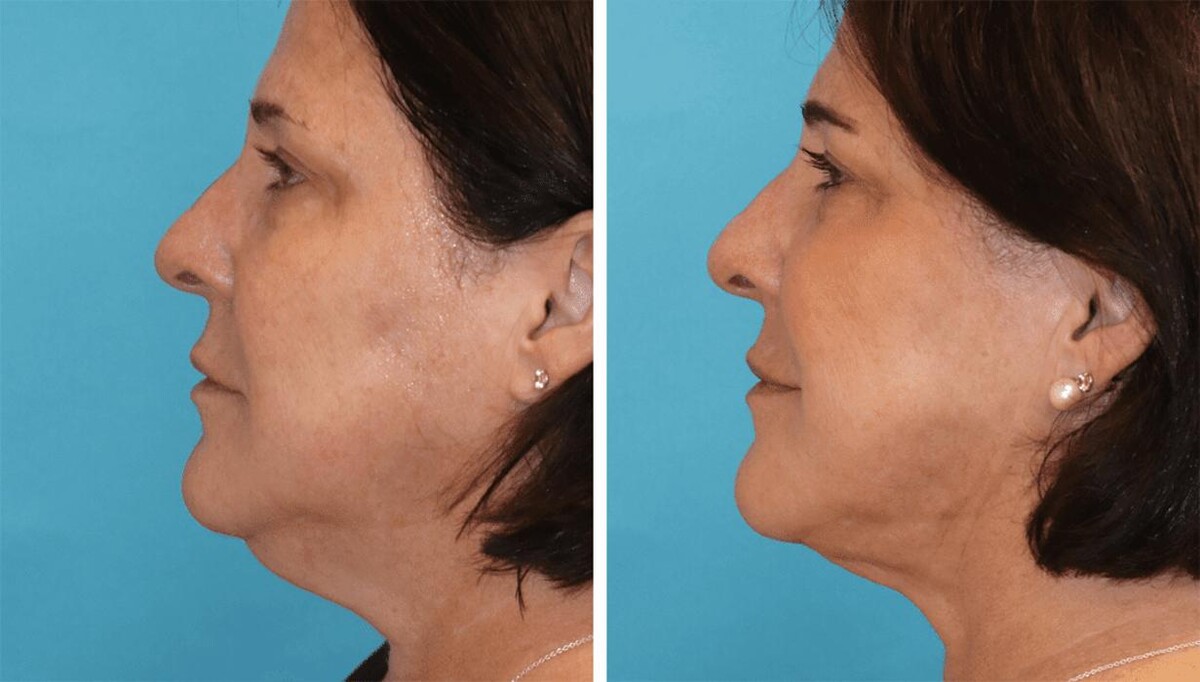 Images Eugenie Brunner, MD, FACS