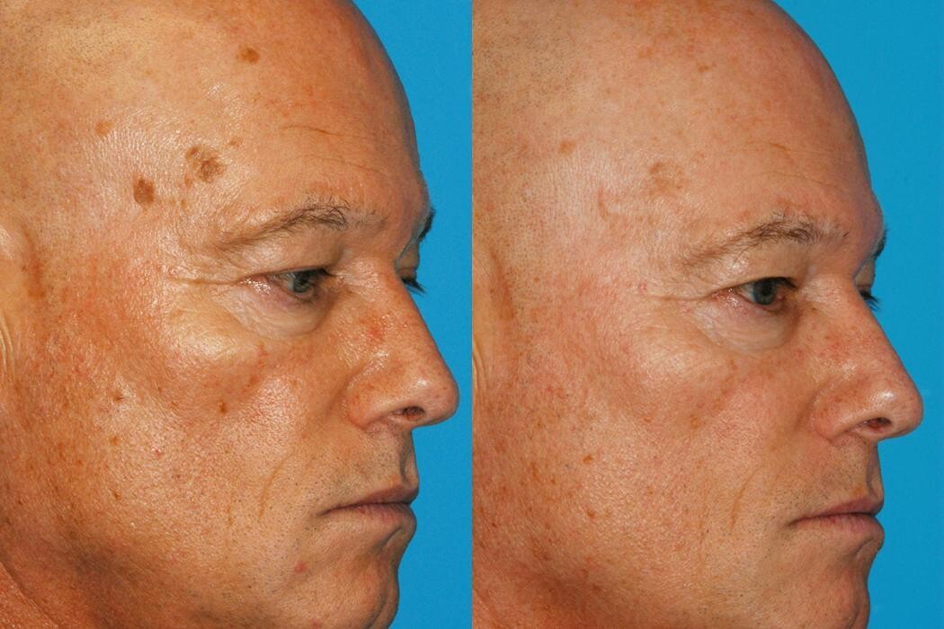 Images Eugenie Brunner, MD, FACS