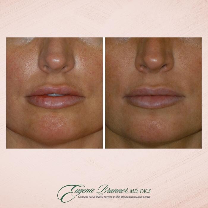 Images Eugenie Brunner, MD, FACS