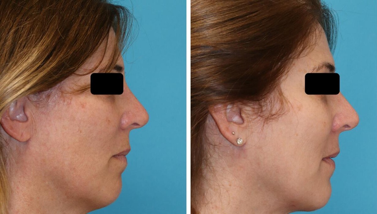 Images Eugenie Brunner, MD, FACS