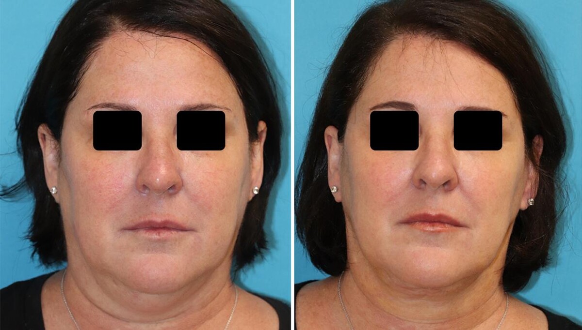 Images Eugenie Brunner, MD, FACS