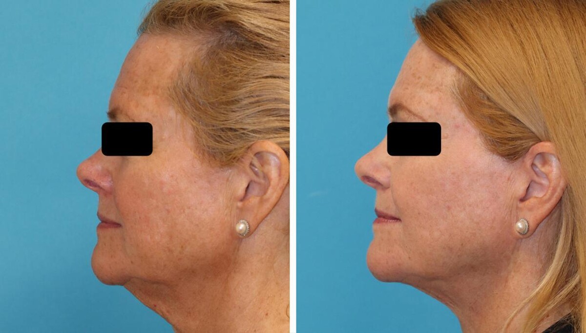 Images Eugenie Brunner, MD, FACS