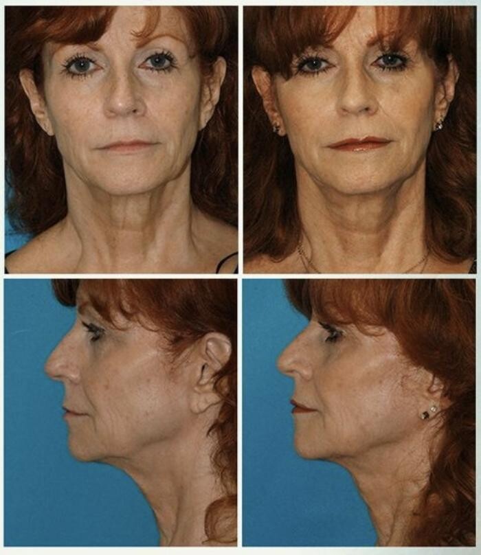 Images Eugenie Brunner, MD, FACS