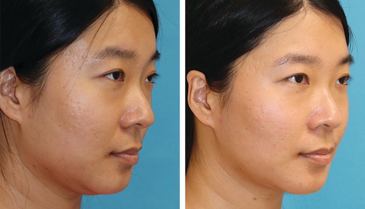 Images Eugenie Brunner, MD, FACS