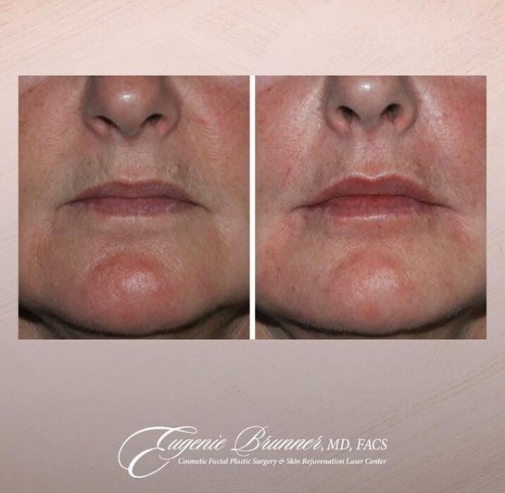 Images Eugenie Brunner, MD, FACS