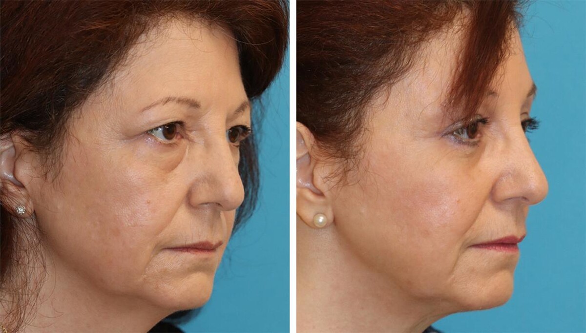 Images Eugenie Brunner, MD, FACS