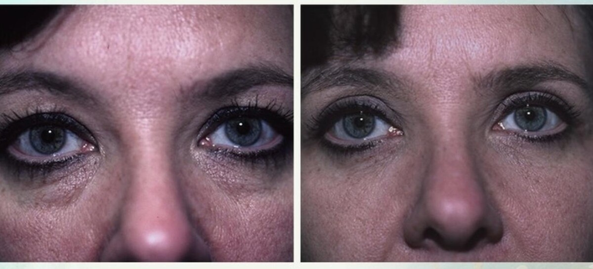 Images Eugenie Brunner, MD, FACS