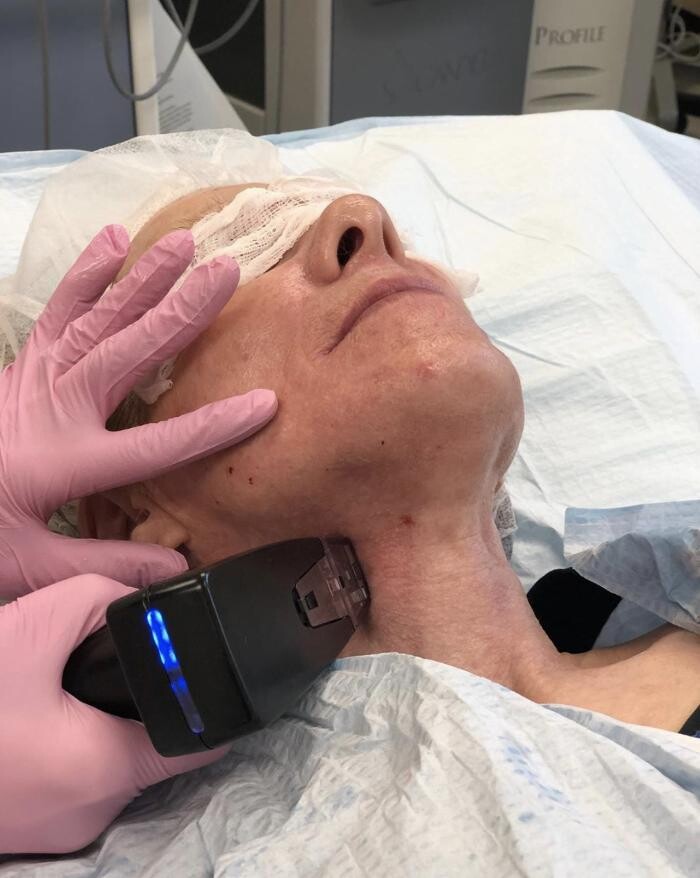 Images Eugenie Brunner, MD, FACS