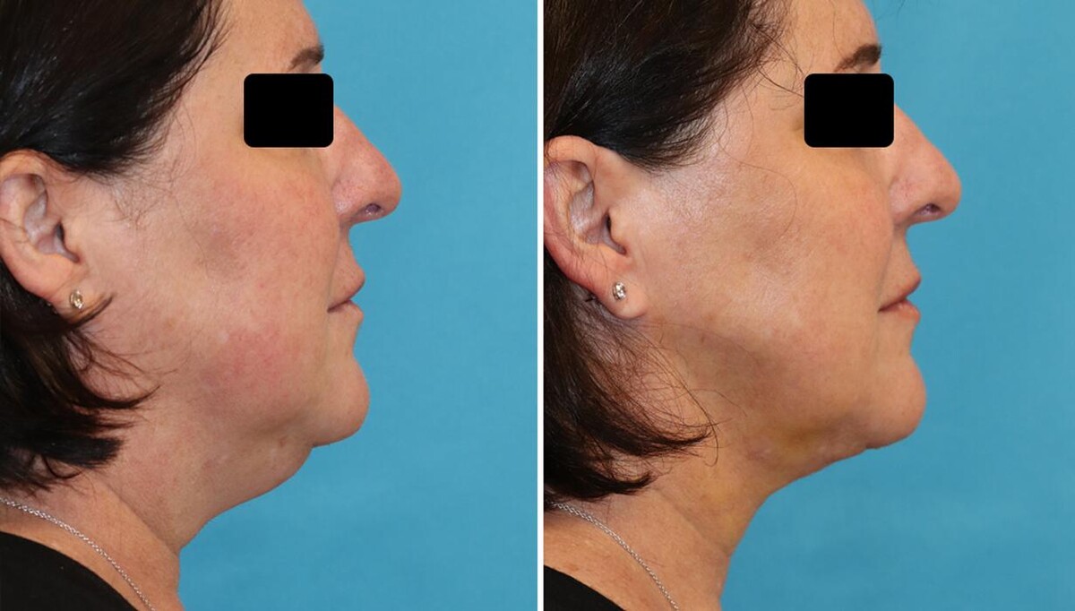 Images Eugenie Brunner, MD, FACS