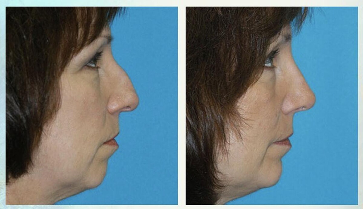 Images Eugenie Brunner, MD, FACS