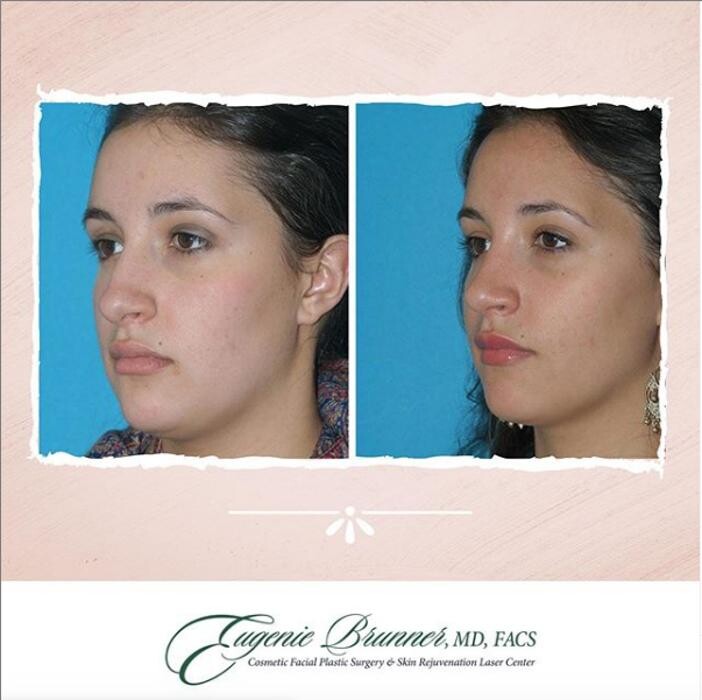 Images Eugenie Brunner, MD, FACS