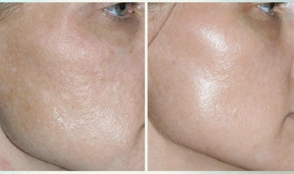 Images Eugenie Brunner, MD, FACS