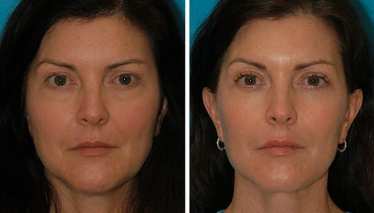 Images Eugenie Brunner, MD, FACS