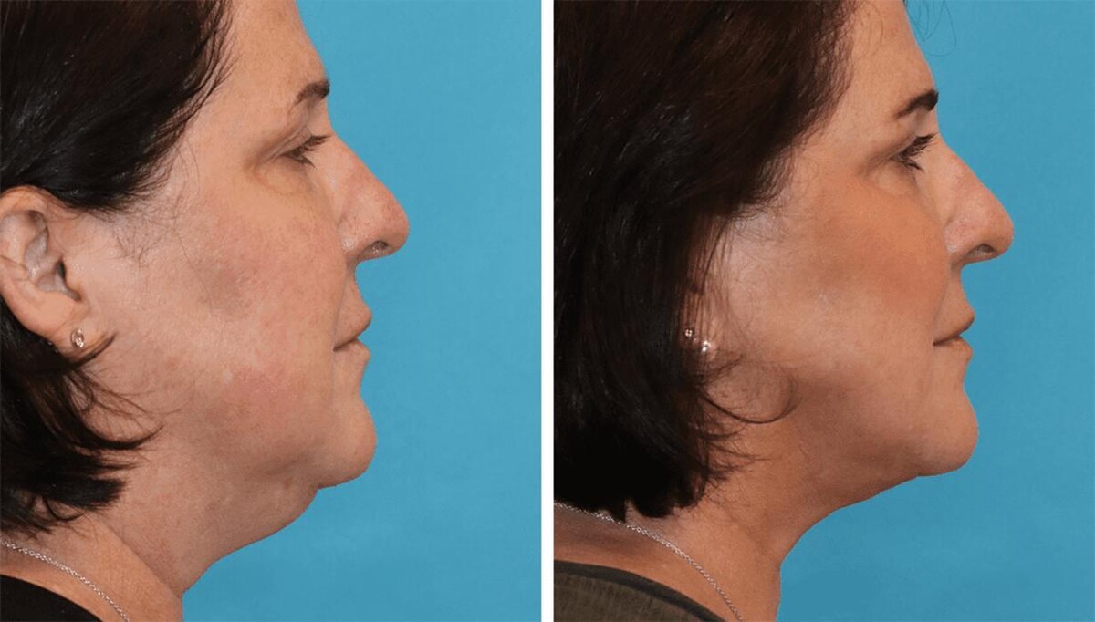 Images Eugenie Brunner, MD, FACS