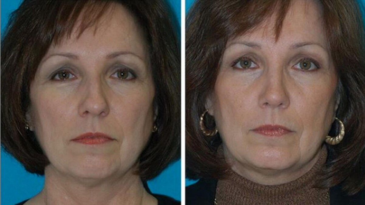 Images Eugenie Brunner, MD, FACS