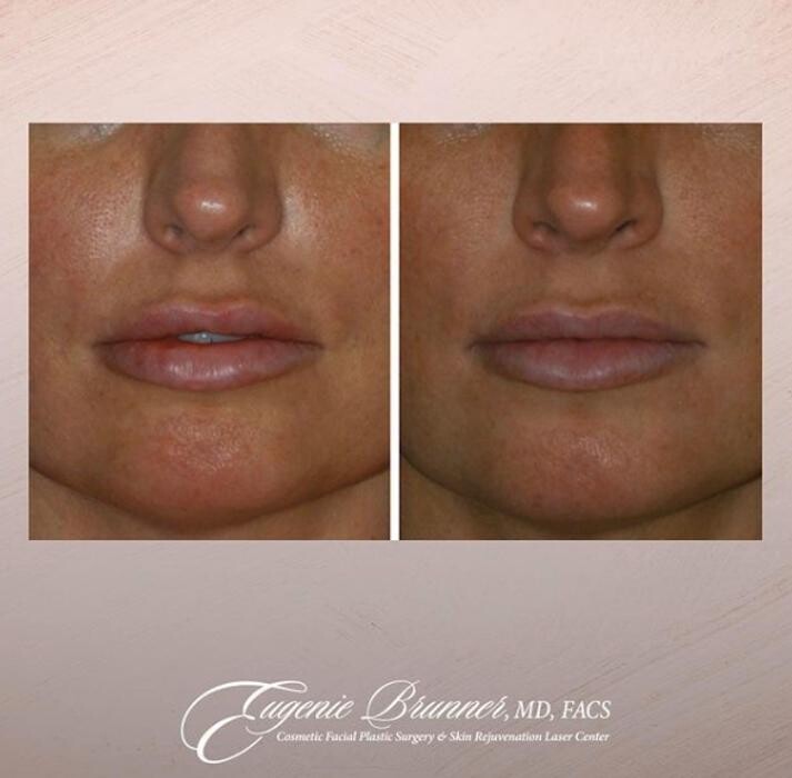 Images Eugenie Brunner, MD, FACS