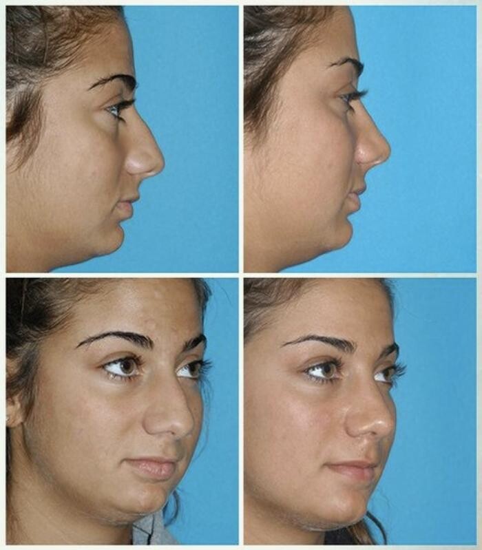 Images Eugenie Brunner, MD, FACS