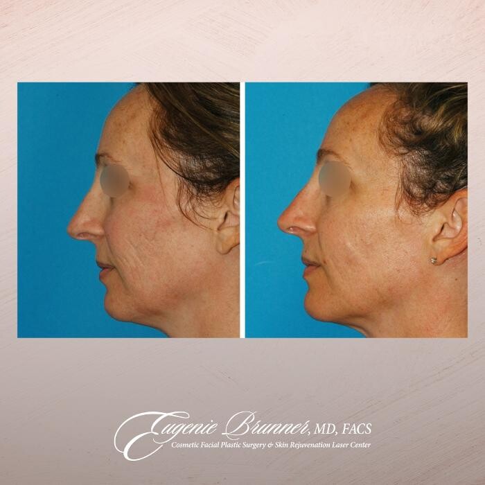 Images Eugenie Brunner, MD, FACS