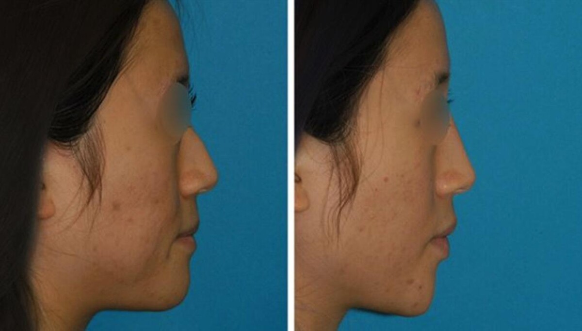 Images Eugenie Brunner, MD, FACS