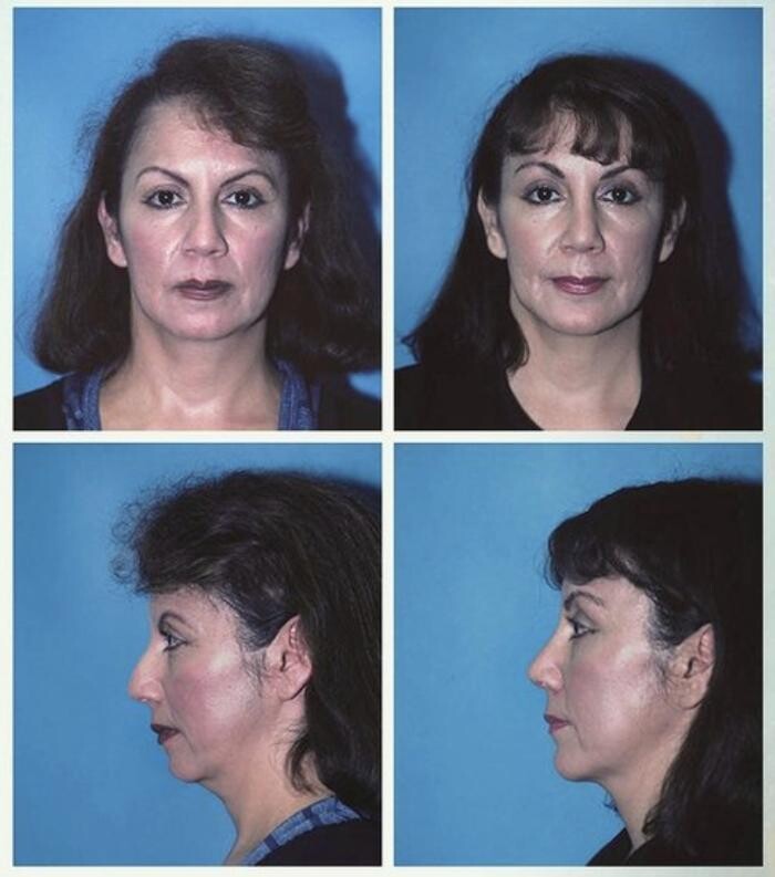 Images Eugenie Brunner, MD, FACS