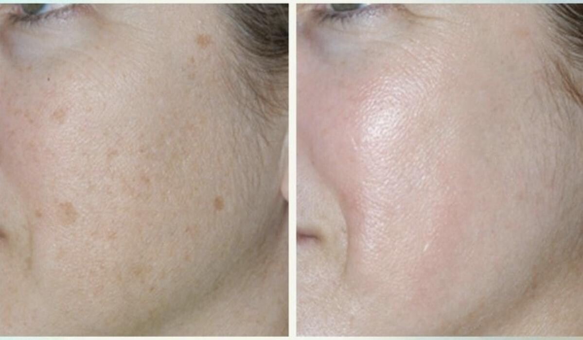 Images Eugenie Brunner, MD, FACS