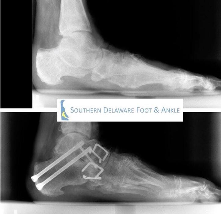 Images Southern Delaware Foot & Ankle: Millsboro