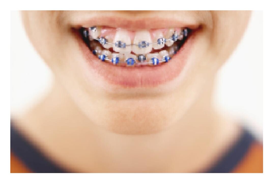 Images Lakeshore Orthodontics, PLC