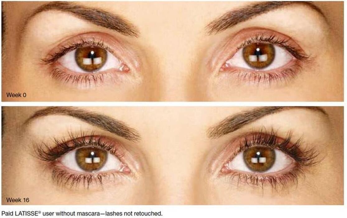 Images North Metro Dermatology
