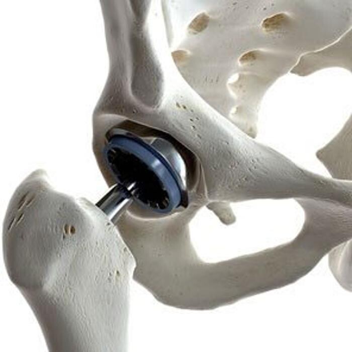 Images SJ Injury Attorneys