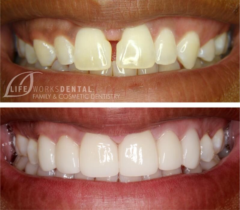 Images Lifeworks Dental