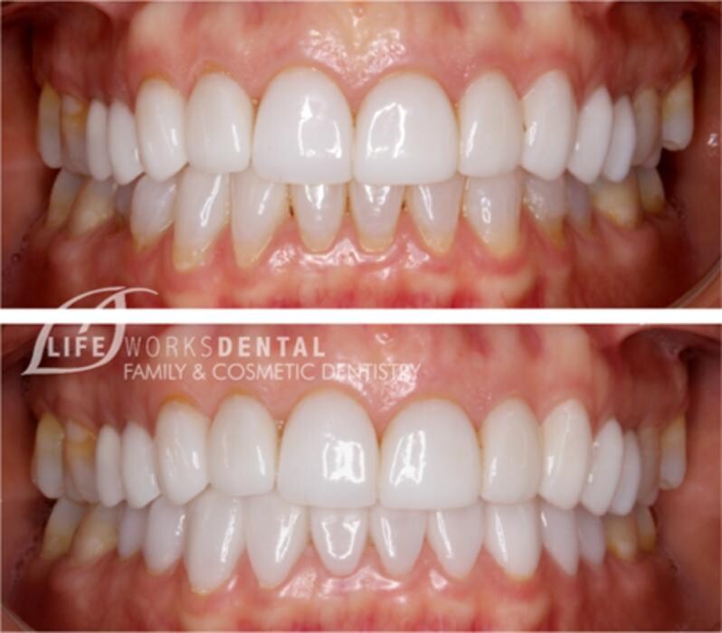 Images Lifeworks Dental