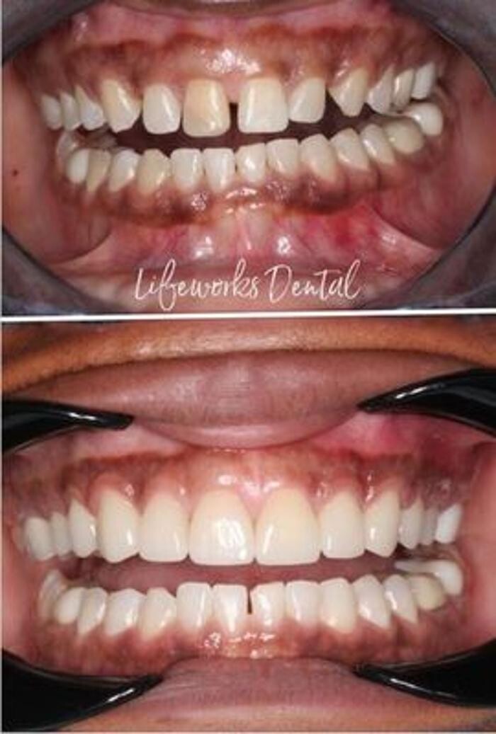 Images Lifeworks Dental