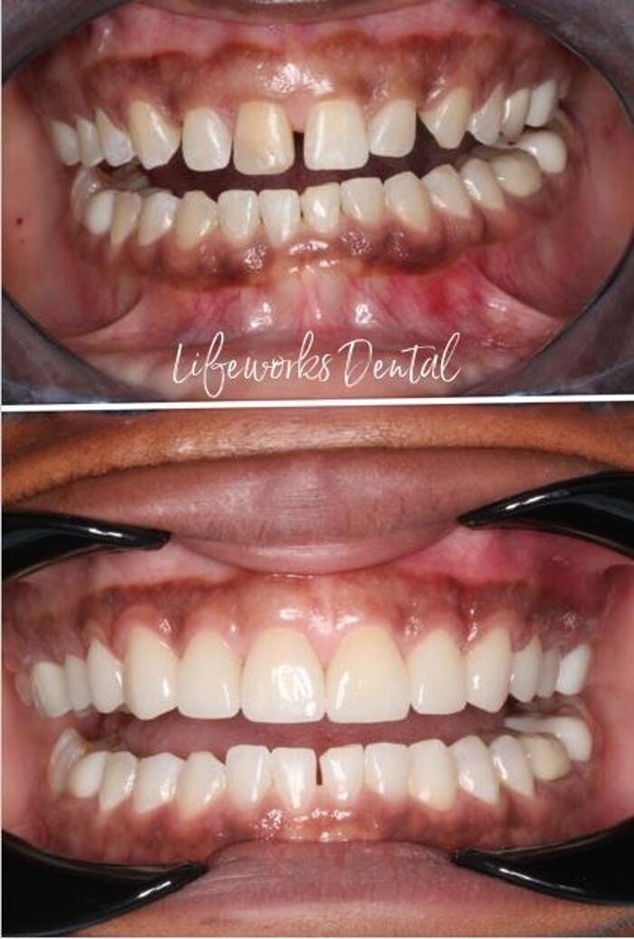 Images Lifeworks Dental