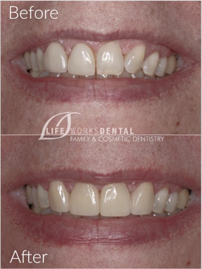 Images Lifeworks Dental