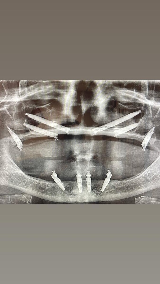 Images DAVID W. EPSTEIN DDS, INC