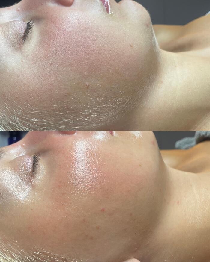 Images Pure Lux Medspa