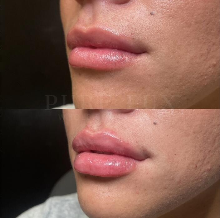 Images Pure Lux Medspa