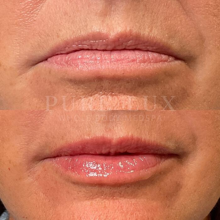 Images Pure Lux Medspa