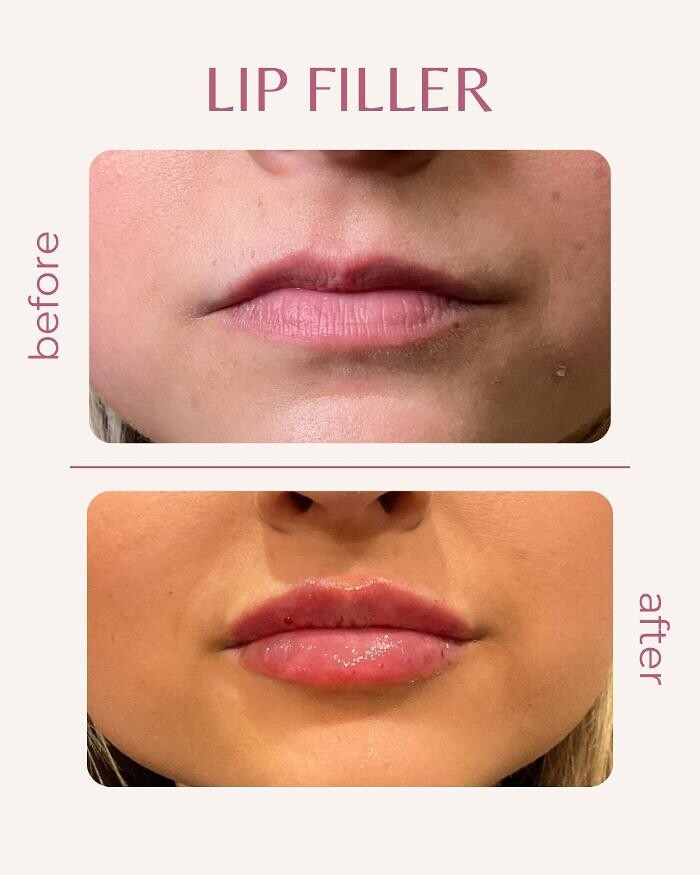 Images Pure Lux Medspa
